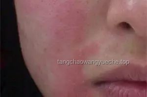第二届小动物皮肤病论坛过敏主题实战指南：4位专家共解临床诊疗难题
